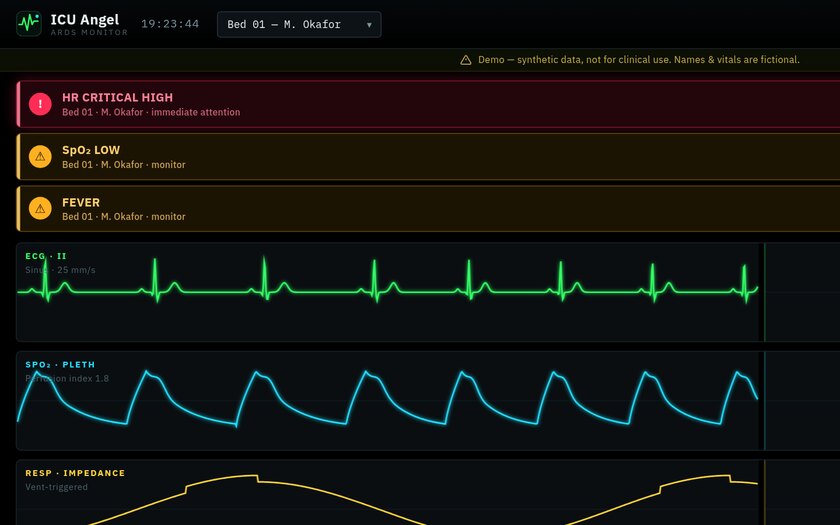 ICU Angel — live prototype by Gideon Awolesi